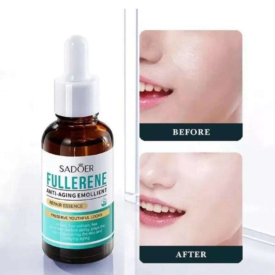 SADOER Fulleron bilen ýaşa garşy serum