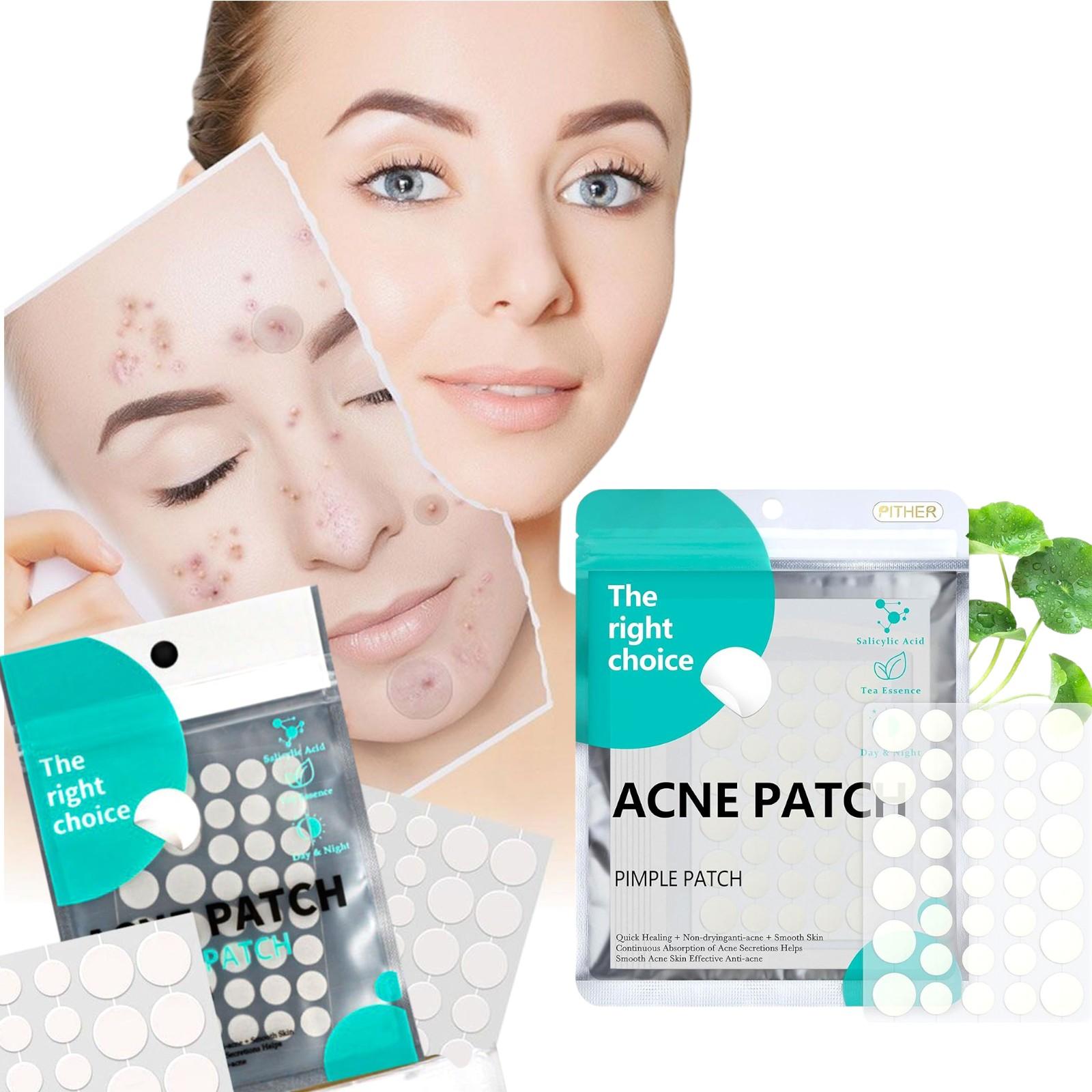 Düwürtige garşy patçi