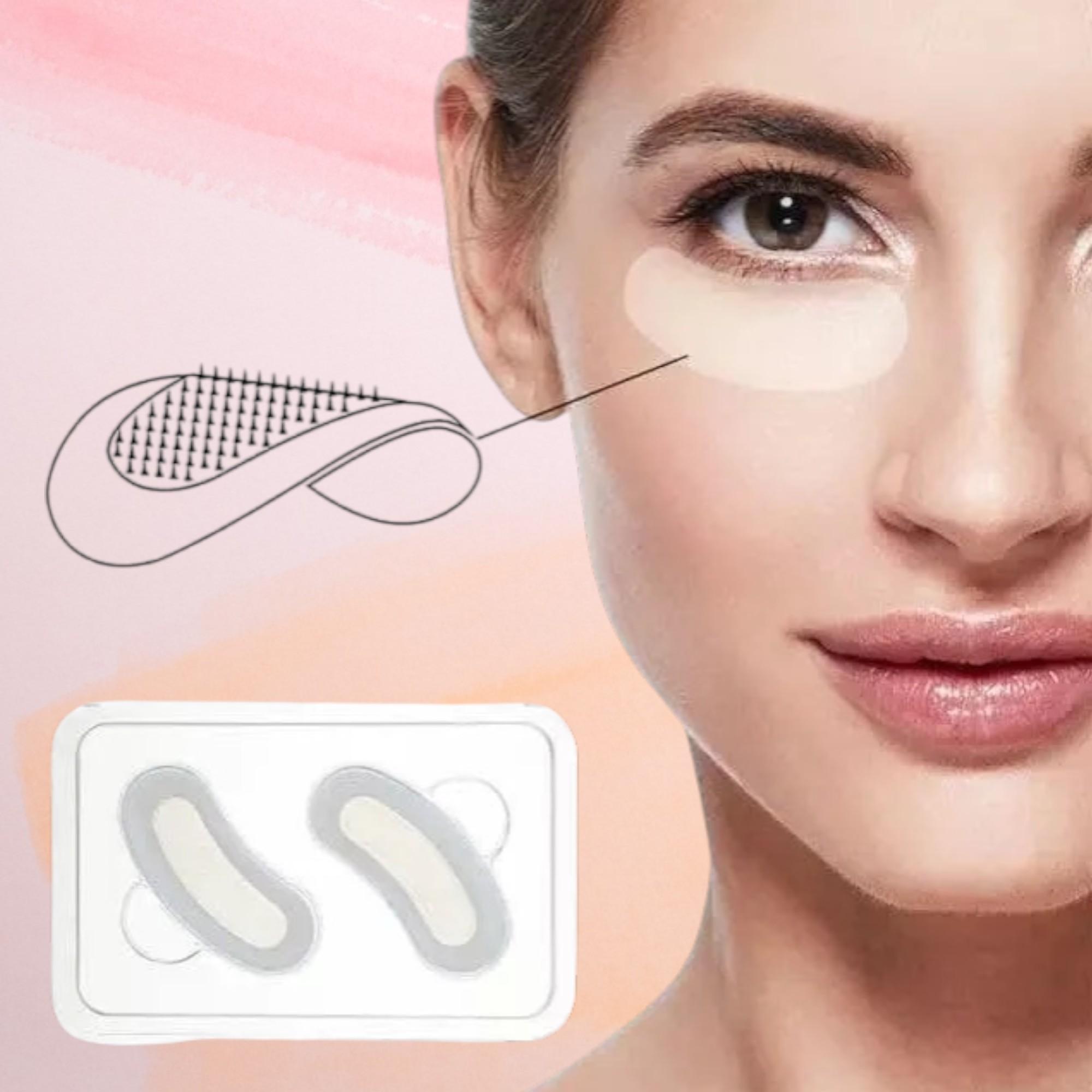 Mikroneedller we gialuron turşusy bilen göz ýamalary.